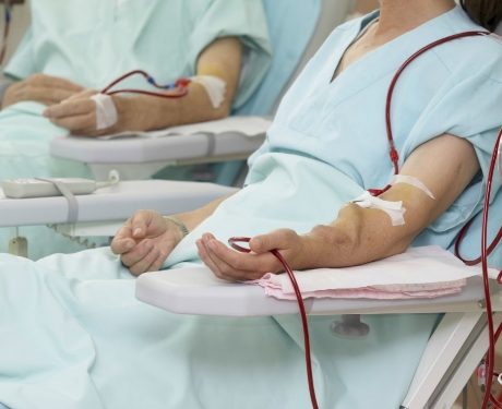 Kidney Transplant Dialysis