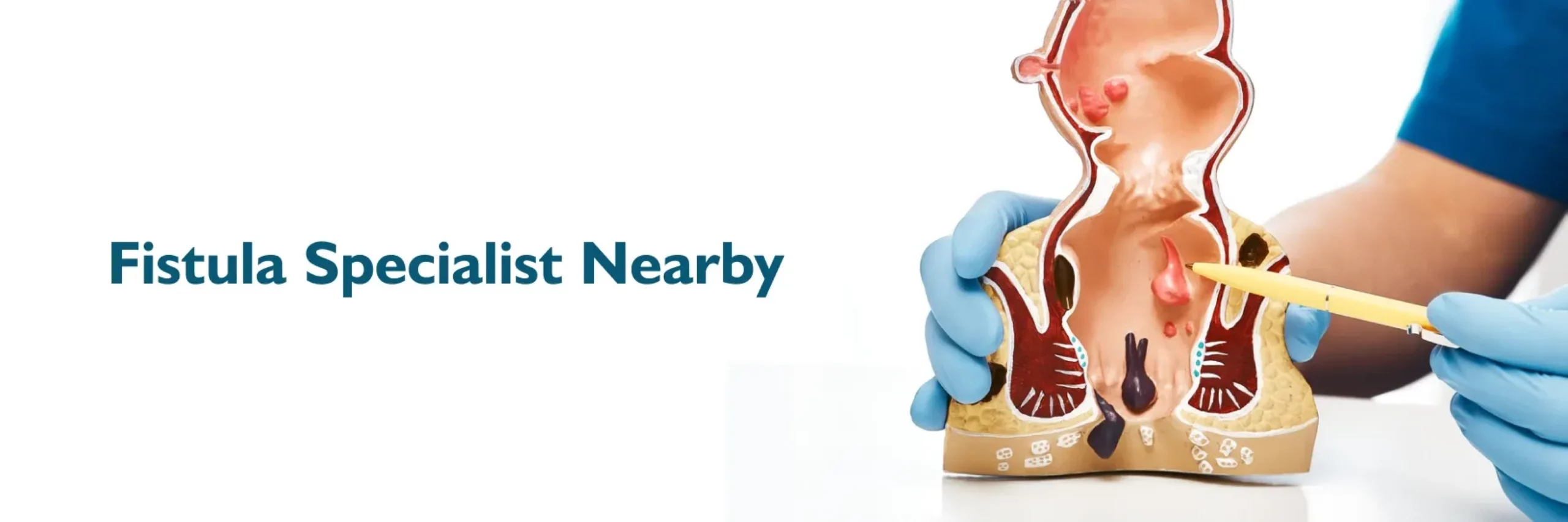 Fistula Specialist Nearby 1