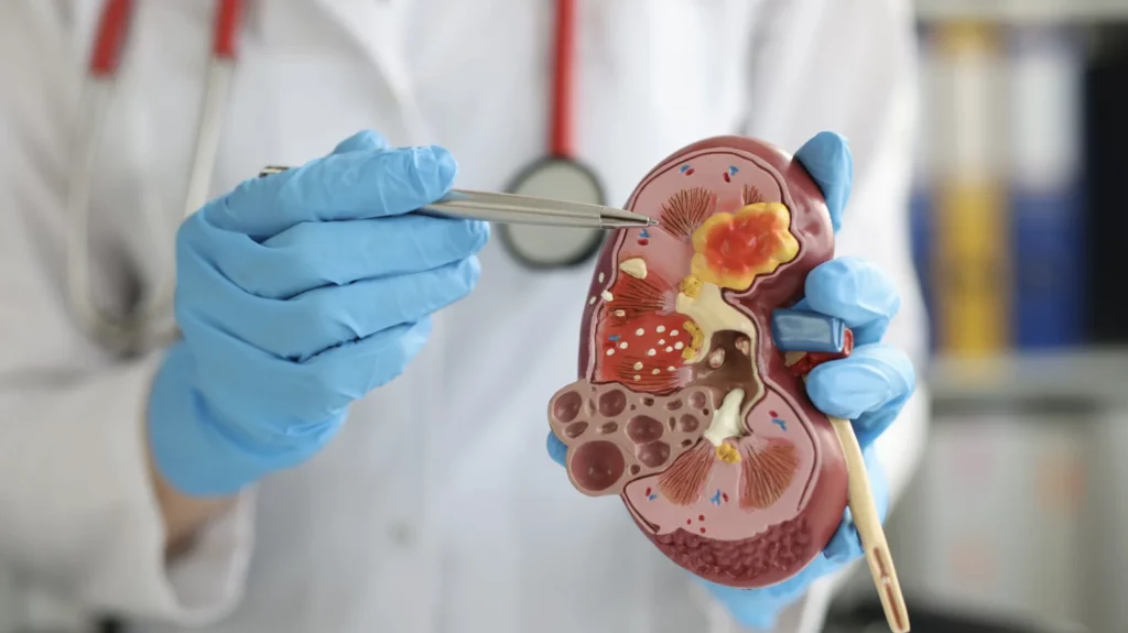 Healthy Kidneys
